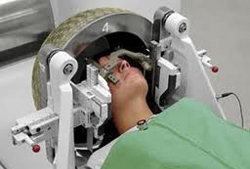 אדנומה של בלוטת יתרת המוח טיפול רדיוכירורגי 2