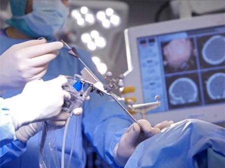 כריתת גידול אנדוסקופית במוח Endoscopic resection of brain tumor